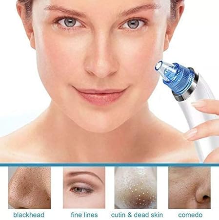 PORTABLE FACIAL PORE CLEANSER (4 IN 1)
