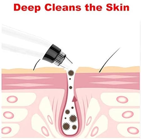 PORTABLE FACIAL PORE CLEANSER (4 IN 1)