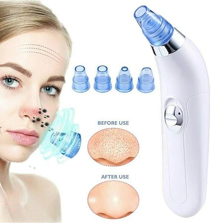 PORTABLE FACIAL PORE CLEANSER (4 IN 1)